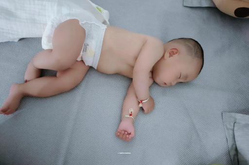 巴中宝宝头上长痱子